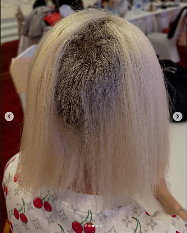 DJ Soda Loses Half of His Hair Due to Side Effects of Bleaching, It Takes Two YearsYes