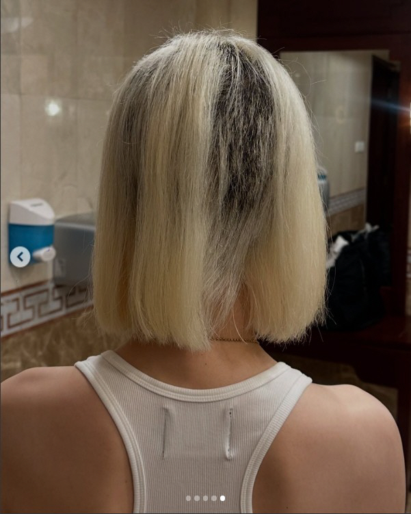 DJ Soda Loses Half of His Hair Due to Side Effects of Bleaching, It Takes Two YearsYes