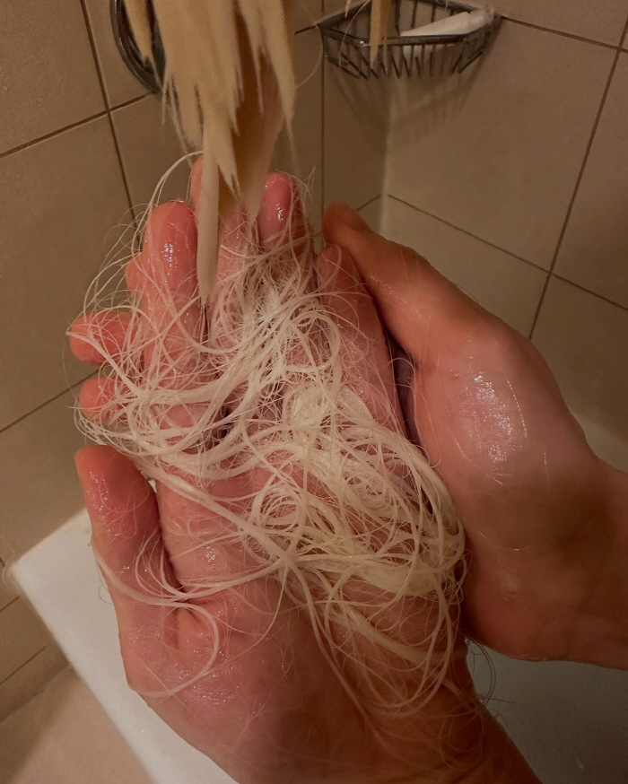DJ Soda Shocked Hair Loss...I bleached my hair and left it for a long time, and it melted from the roots