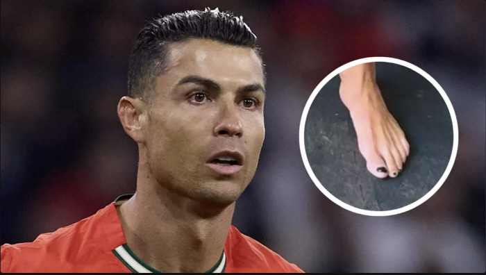 What's wrong with Ronaldo's toenails? I'm curious. Why did Ronaldo get a black nail polish