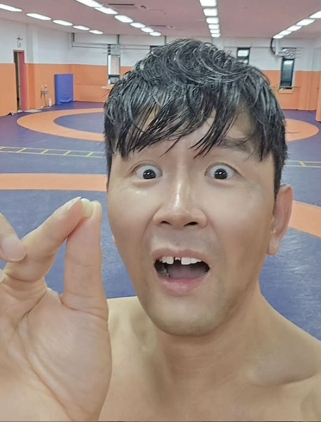 'Jung Kyung-mi ♥' Yun Hyung-bin is shocked by the disappearance of his front teeth...a major accident in preparation for the game