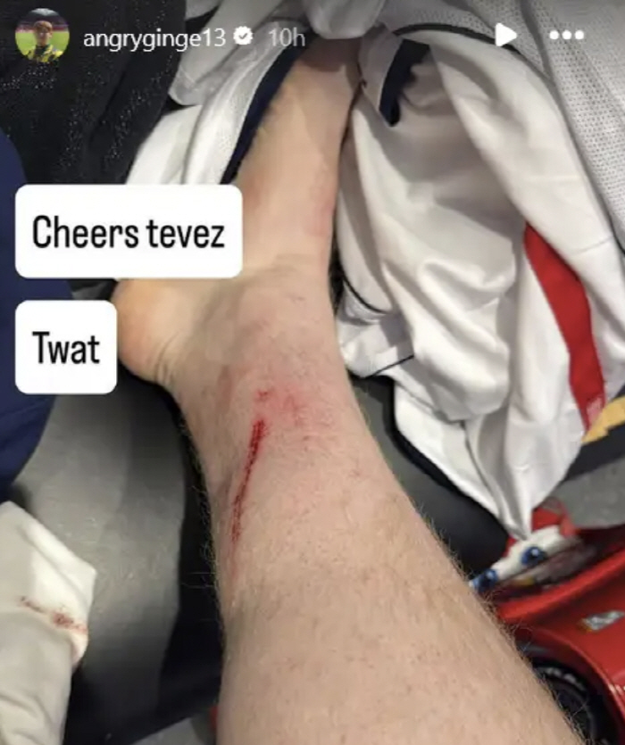 Park Ji-sung's best friend. Do you have a personality problem?Murder tackles → Victim YouTuber's swearing anger at charity games