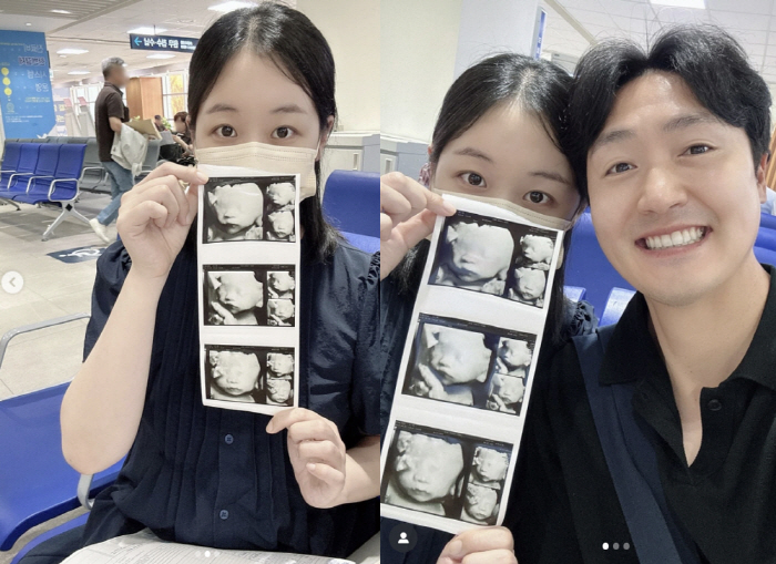Two years later, the sorrow of losing my son...Park Bo-mi reveals her miraculous daughter's ultrasound. An angel with a clear nose