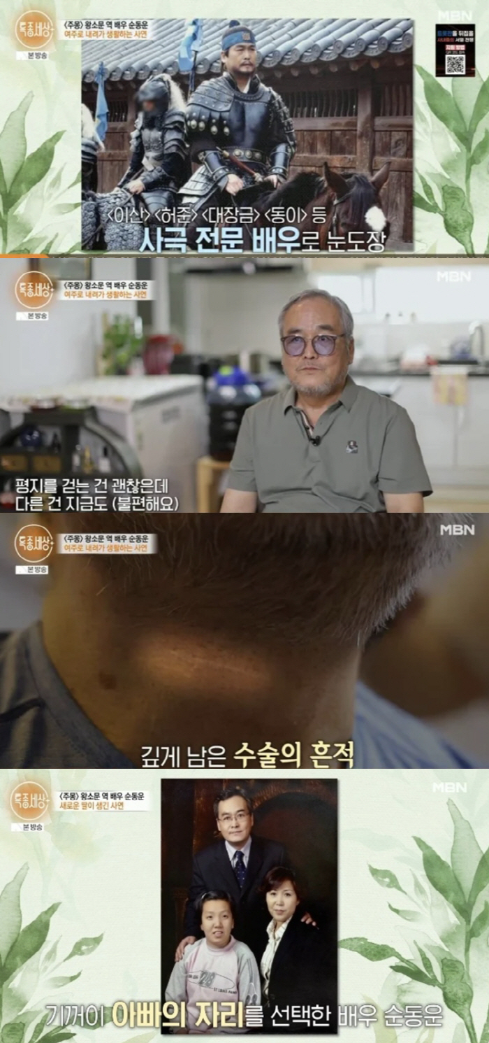 Sun Dong-woon's fall resulted in a general paralysis and a second-class intellectual disability daughter. 