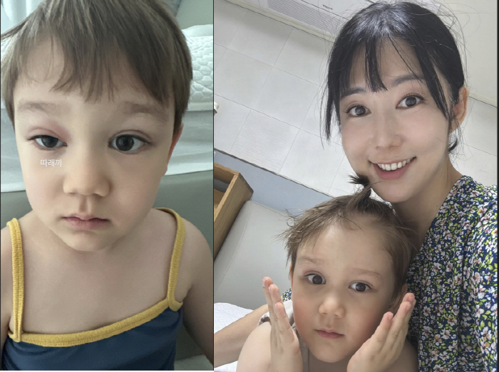 Sayuri Jen, what happened to your red, swollen eyes?I can't even open my eyes