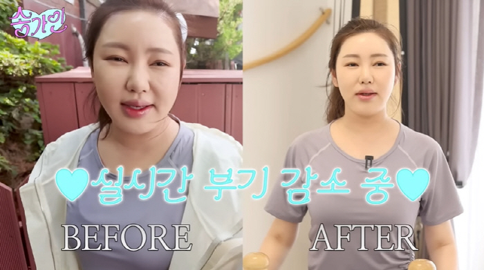 Song Ga-in hits 45kg and loses more weight, but before and after swelling reduction exercise unconditionally (Song Ga-in)