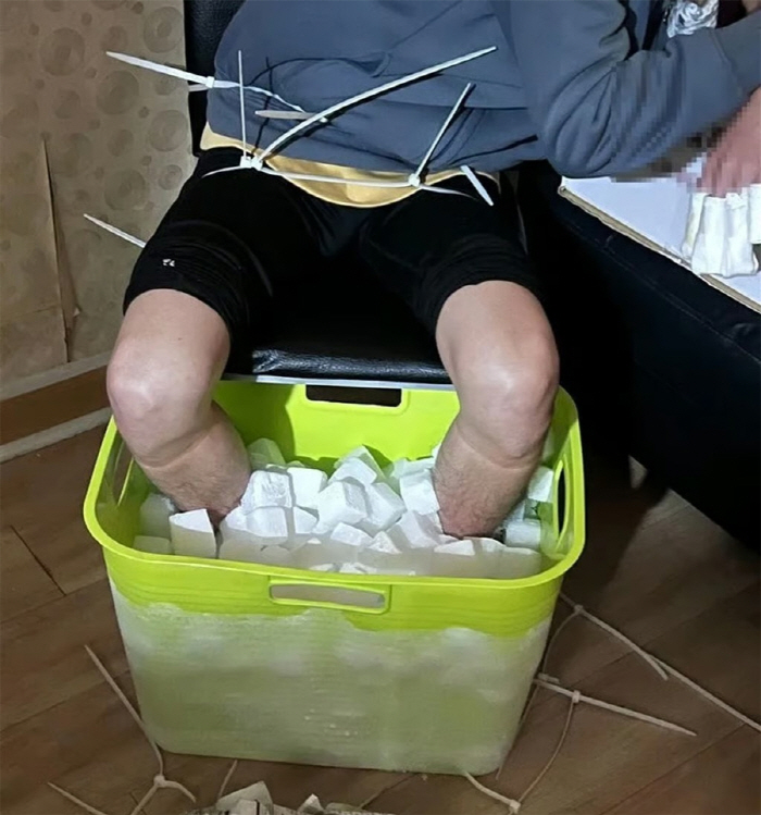Put both feet in dry ice for 10 hours to cut...Aiming for KRW 1.9 billion in insurance money