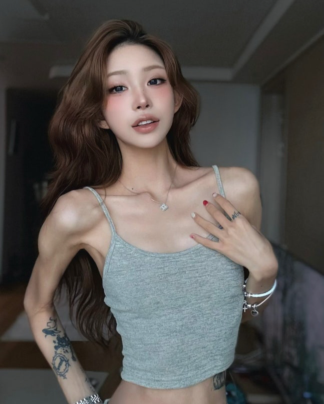  My bones are rotting...Choi Junhee, 96 → 41kg bone porridge diet side effects? progression of pelvic necrosis