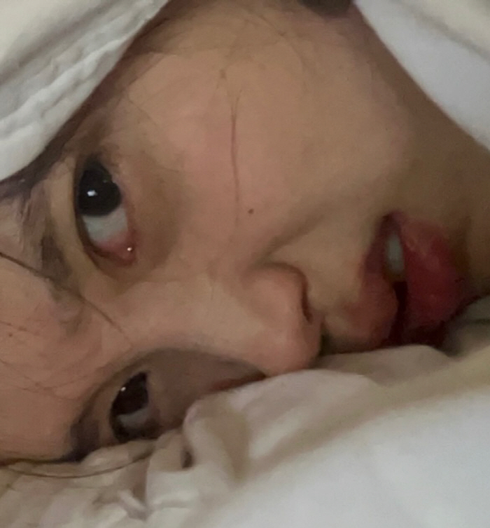 IU attacks her bare face. Is she a 31-year-old? Pottery skin cleaner than a baby