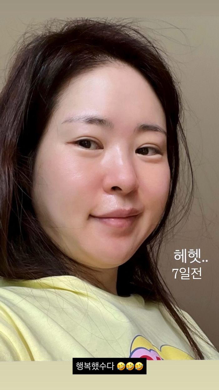 Kim Tae-hyun ♥ Mija, 53 → 48kg lost in just 5 days. Shocking before & after