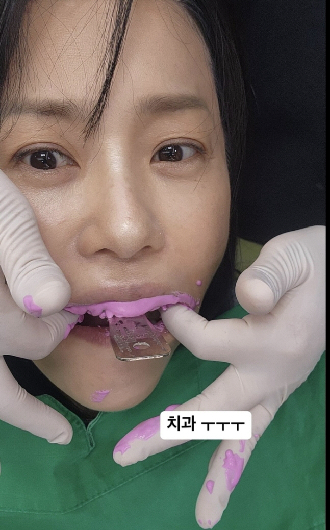 54 years old Ko Hyun-jung is also scared of dentistry..Hold the doll tightly