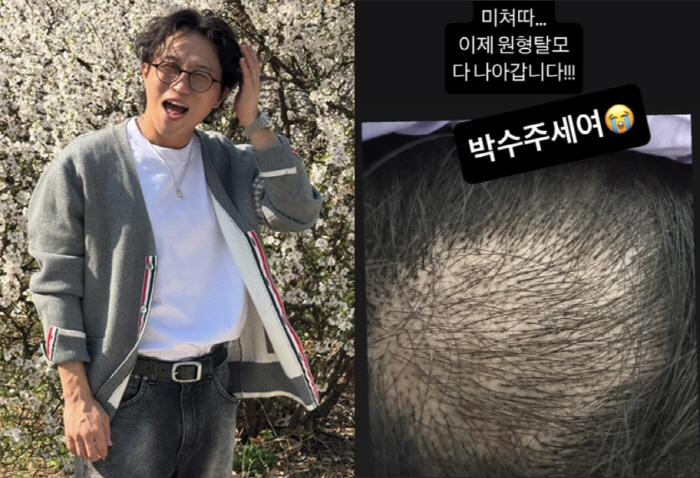 Lee Sol ♥ Park Sung-kwang overcame severe circular hair loss