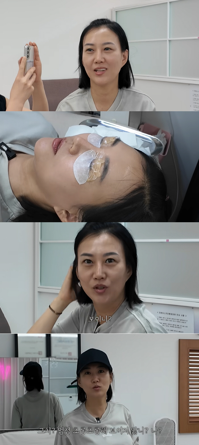 Jang Yoon-jung confessed honestly, 'I got eye surgery'..an even bigger eye