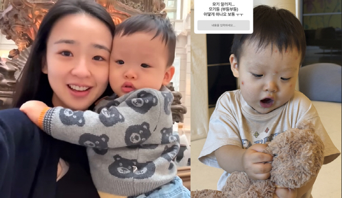New Mom Son Yeonjae, what do you do with S.0.S mosquito allergy during 16-month childcare?