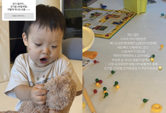 Financier ♥ Son Yeon-jae should take medicine for a 16-month-old hospital tear mosquito allergy