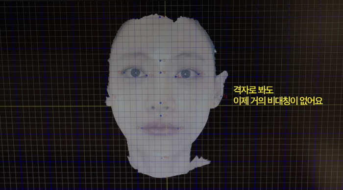 38-year-old Oh Yeon-seo, I didn't want to reveal this picture..A facial surprise that changed after the procedure