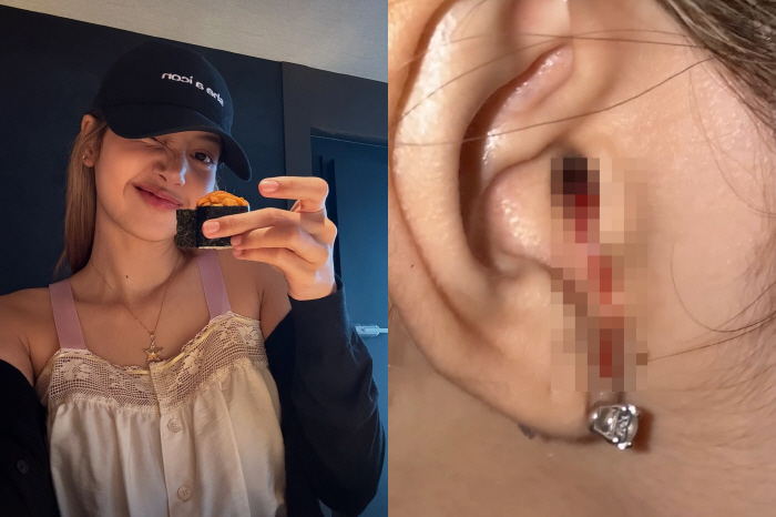BLACKPINK Lisa, are your ears really bleeding?Fans were surprised