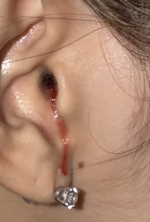 BLACKPINK LISA TIRED IN Ears While Traveling...Comeback as a whole group. 