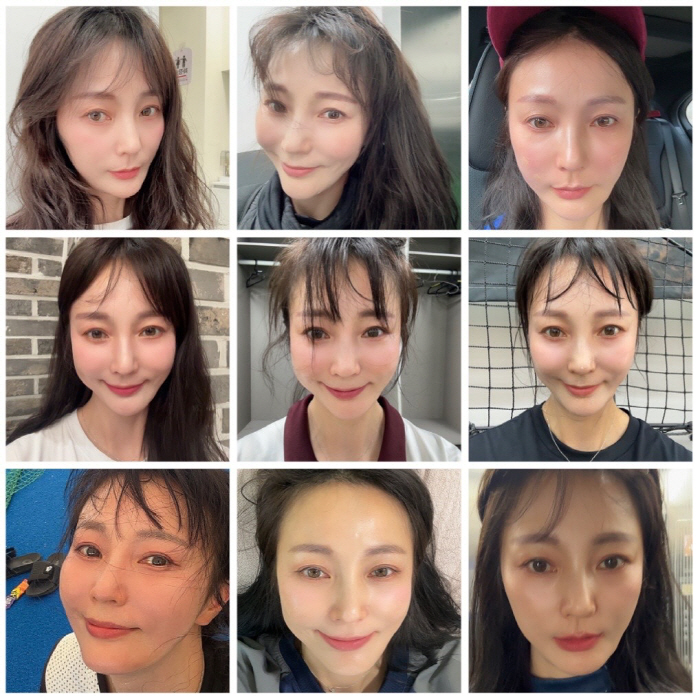 Ahn Hye-kyung, it's been a month since she got stem cells..I can see the change