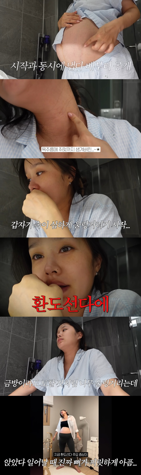 Hey, I'm suffering from severe full term pain, rat milk, neck wrinkles..My hands are swollen, too