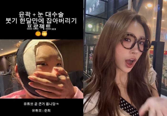 Choi Jin-sil's daughter Choi Jun-hee catches the swollen face surgery after plastic surgery
