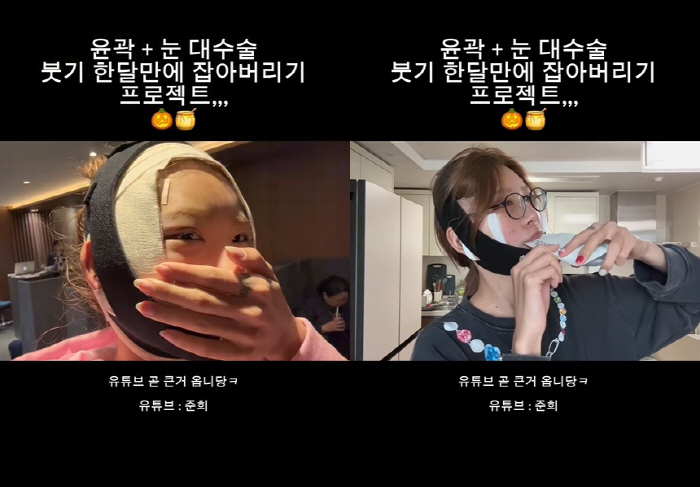Choi Jin-sil's daughter, Choi Jun-hee, doesn't touch the bones in her face that have changed since her cheekbones got plasticized