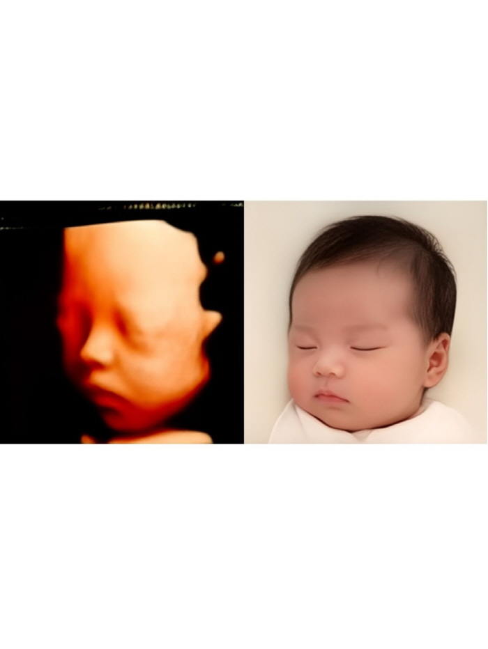 Han Jung-min of the Dol Singles 3 marries racing model Yoo Da-yeon...Pregnancy first. 