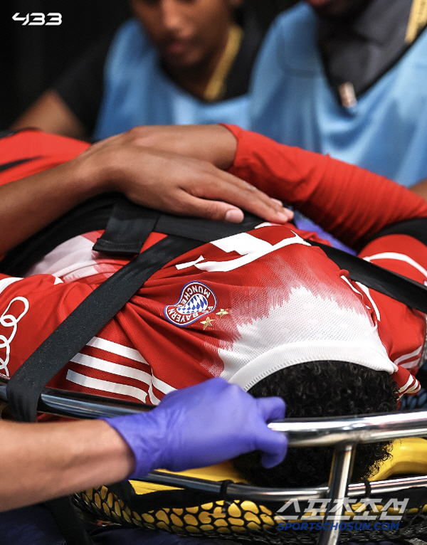 What happened to Donnarumma? Genius Musiala. Munich angry at the fatal injury...Four to five months' absence is inevitable due to a calf fracture