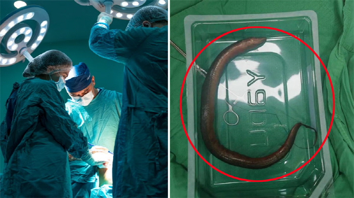 30cm eel wriggle alive in the stomach...How did I get in there?