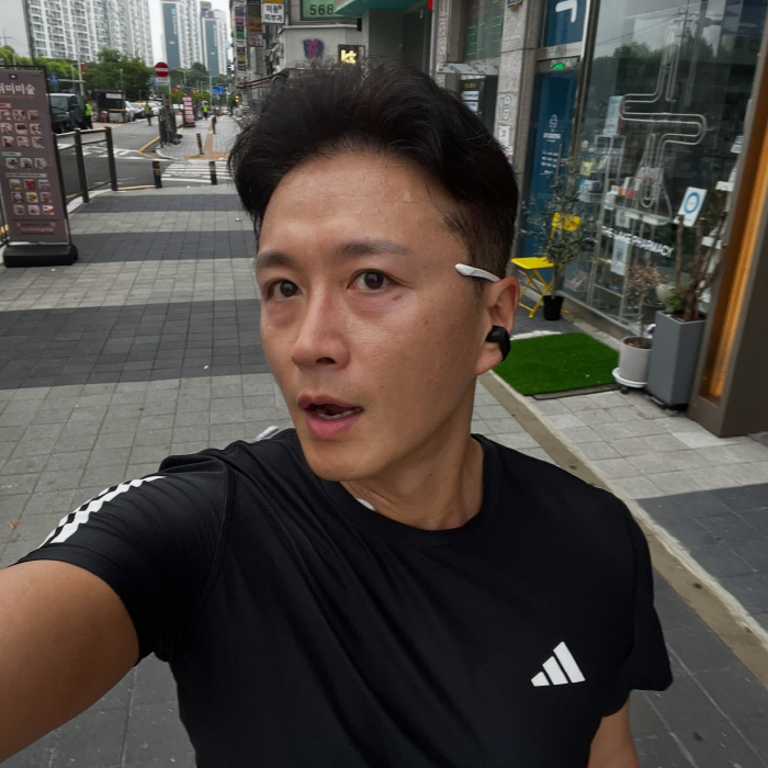 Jin Tae-hyun holds thyroid cancer surgery marks...Jogging starts in 2 weeks 