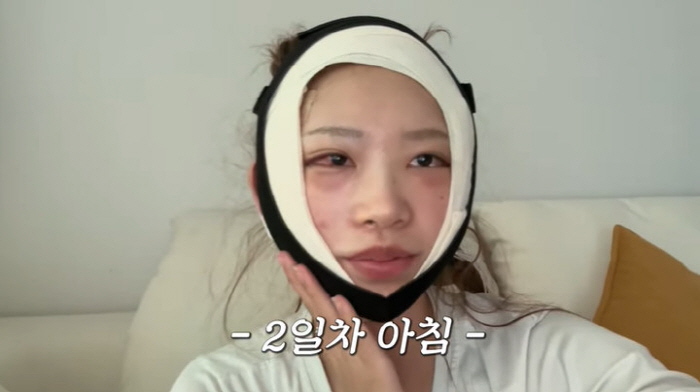 Choi Jin-sil's daughter Choi Jun-hee doesn't see any serious swelling after cheekbones and eye plastic surgery