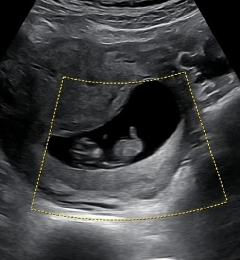 For the first time in 13 years, KCM reveals its two daughters. It's going to be a father of three children. It's a pretty gift
