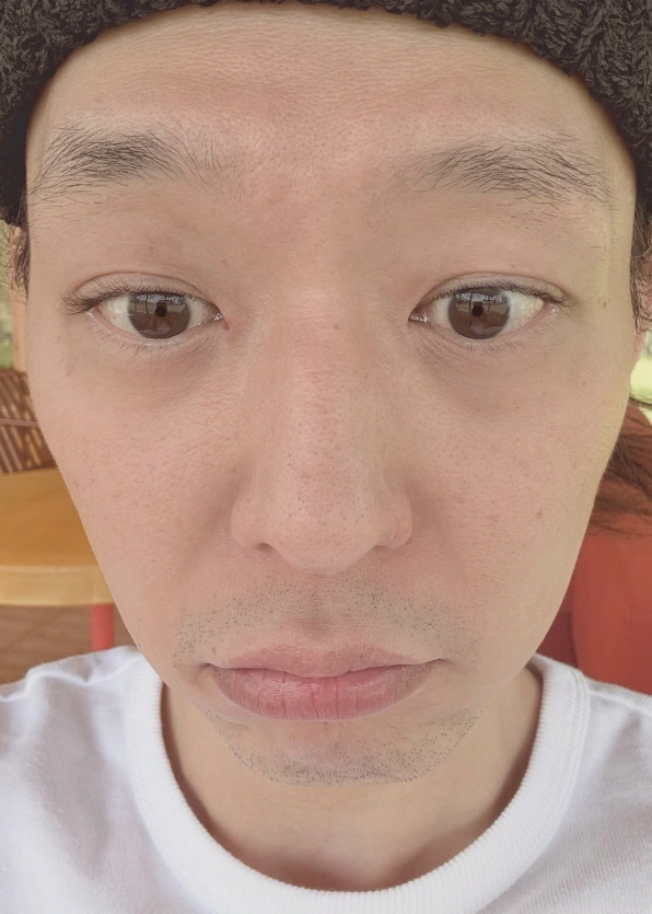  Park Yoo-chun, Drug → Recent state after reversal of retirement..Wider forehead → Stretched pores. It's true