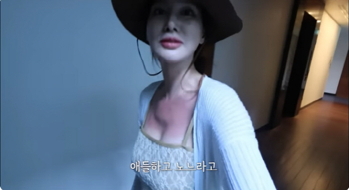 Ahn Jung-hwan ♥ Lee Hye-won got burned during a trip to Bali It hurts so much that I can't even wear clothes