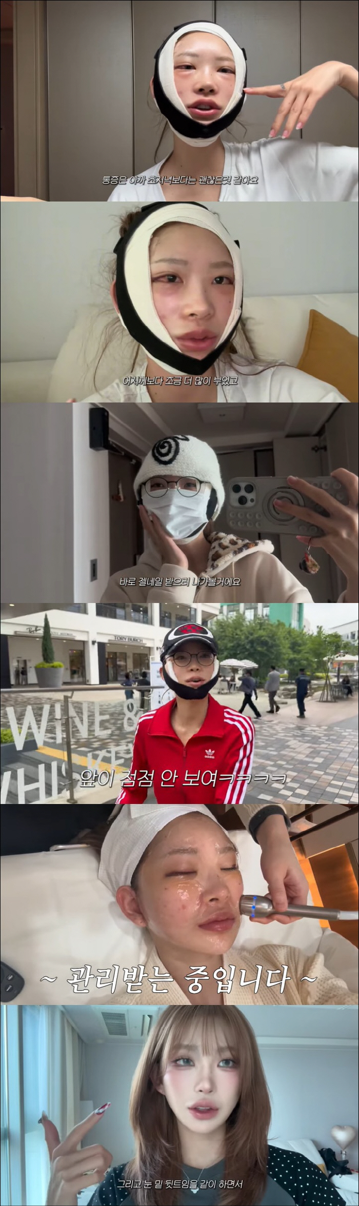 Choi Jin-sil's daughter Choi Jun-hee poured white into cheekbones and eye plastic surgery...A surprising change in a month