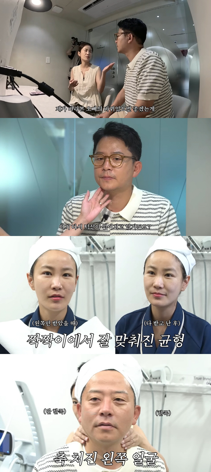 Kim Ji-min ♥ Kim Jun-ho lost 7kg due to gastric emptying → Yoyo lifting jawline disappears