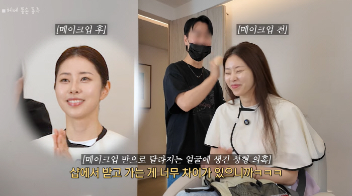 remarried Seo Dong-ju, a different face..It's just a difference between plastic surgery and makeup