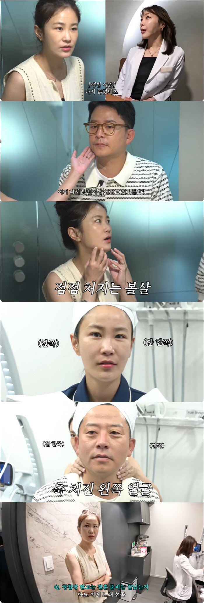 Kim Jun-ho, Yoyo came as soon as he hung up due to the side effects of WeGobi Your jawline is gone