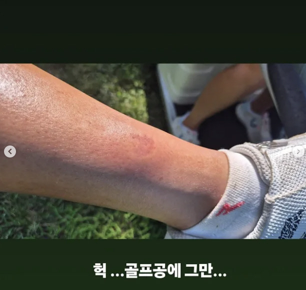 Park Jun-hyung ♥ Kim Ji-hye, dizzying injury while playing golf...Put a bandage on it and the ball flies to your leg