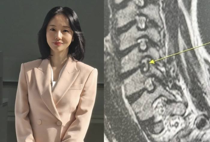 Lee Jung-hyun, a luxury bag point worth 10 million won with a training suit, worth 19.4 billion won