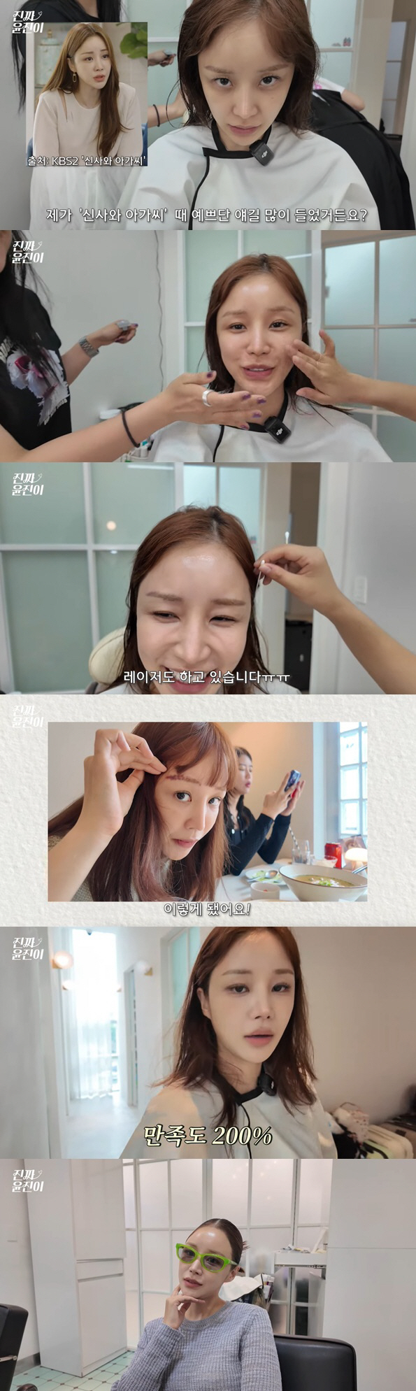 Dermatology 2nd degree burn Yunjin, clear left cheek scar..After makeup, it transforms into smooth skin
