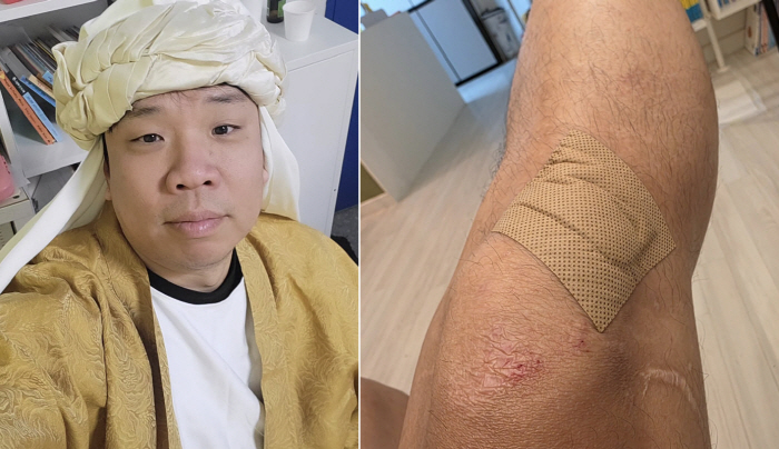 Oh Ji-heon's unfortunate fall accident, 'I hurt my knees again...'There's no day to have sex'