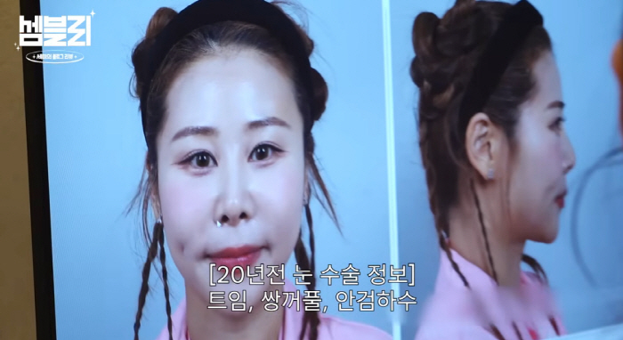 Seo Joon-Mom Park Se-Mi is relieved after consultation whether to re-operate on a nose job with crowded eyes and a deaf nose