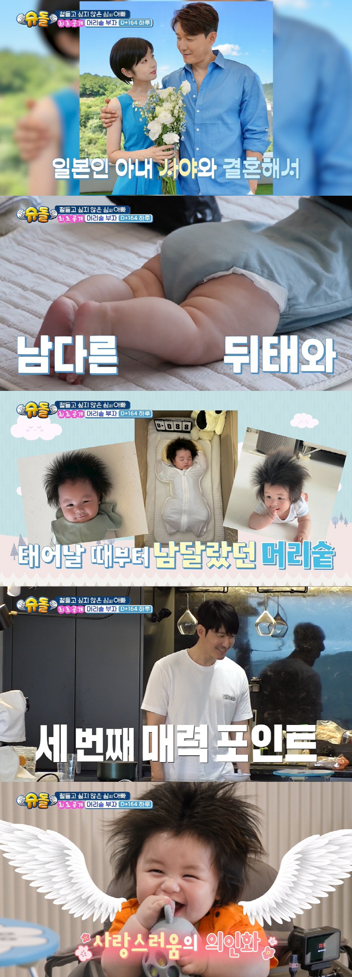 Shim Hyung-tak, Cho Si-on's hair, 9.9kg Superior Children Open with a lot of hair (Sudol)