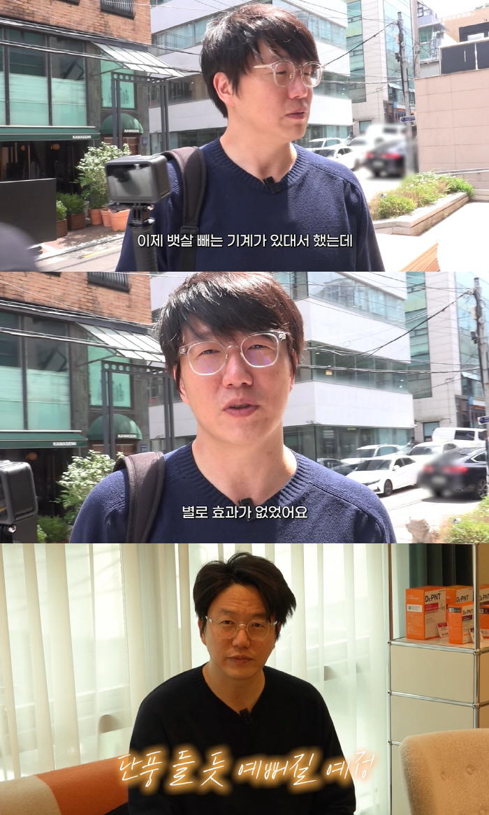 Sung Si-kyung, I'm going to decorate you, but you're being criticized..7.26 million won Flex transformation completed at the dermatologist