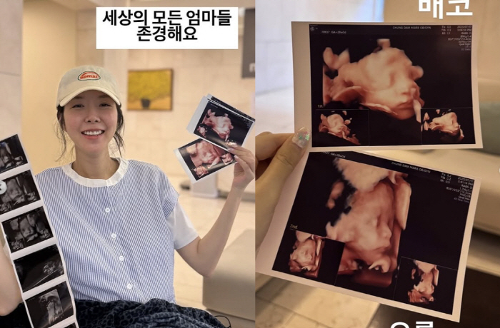 Twin pregnancy Kim Ji-hye, stereoscopic ultrasound sad news, I'm sorry dad..It's because it looks like me