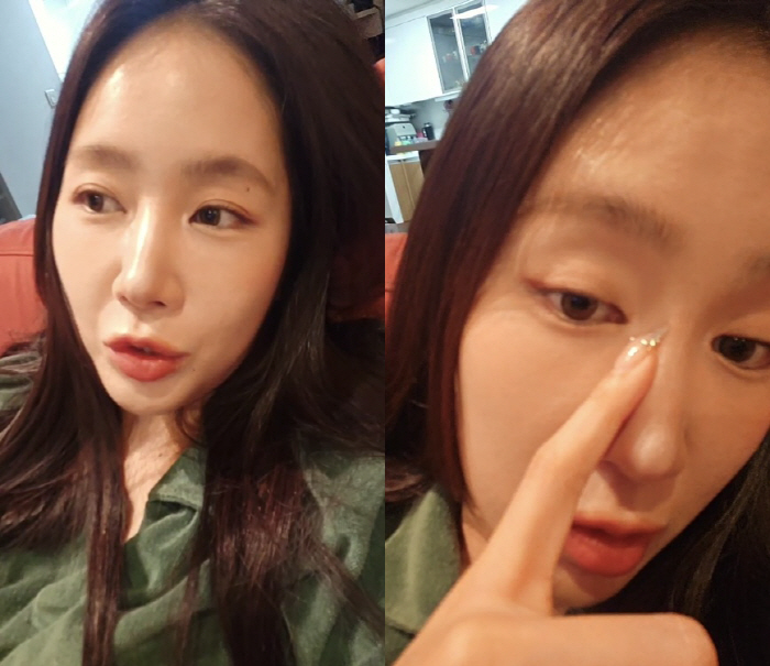 Soyou's facial explanation. It's worth losing 10kg. I'm happy to hear if I got plastic surgery
