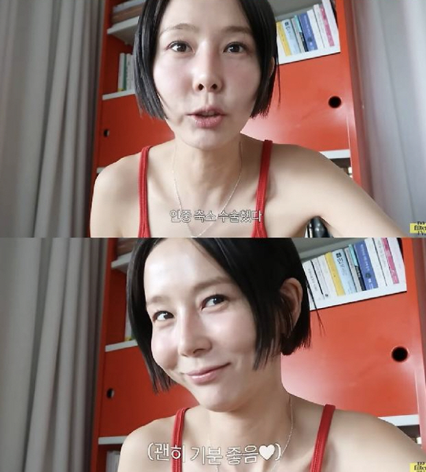 Kim Na-young opened her mouth about plastic surgery Makeup, not philtrum reduction surgery. 