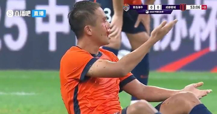 Coach Seo Jung-won's stress index explosion is the most useless naturalized player's uncontrollable problem, severe assault