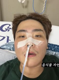 Song Pil-geun survived pancreatic necrosis...I lost 35kg and was on the verge of sepsis